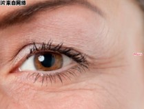 眼部除皱，你知道有哪些方法吗？