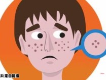 长痘在鼻梁上是身体发出的哪种信号？（长痘长在鼻子上是什么原因）