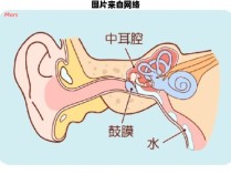 耳膜内陷的成因是什么？