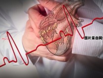 心脏跳动异常的原因是什么