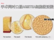 自体脂肪细胞有何特点及用途？