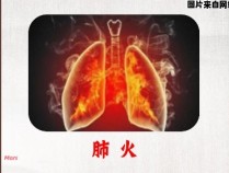 肺部火气旺盛的表现及缓解方法