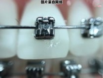 牙颌骨位于人体的哪个部位