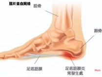 导致脚后跟痛的原因是什么？