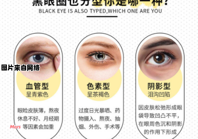如何挑选适合自己的眼霜来消除黑眼圈