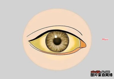 眼睛发黄的原因是什么？如何改善？