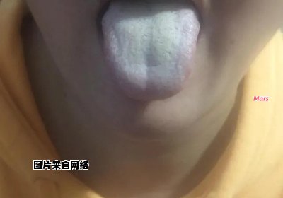 舌苔变黄的原因和治疗方法
