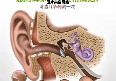 耳垢对日常生活的影响及正确的耳垢清理方法