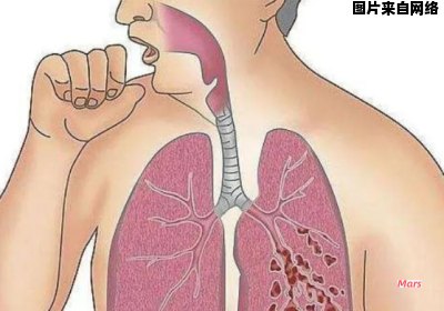 口鼻相连处出现痰液，应该如何处理呢？