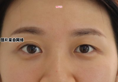 眼皮多层褶皱是年龄引起的吗？